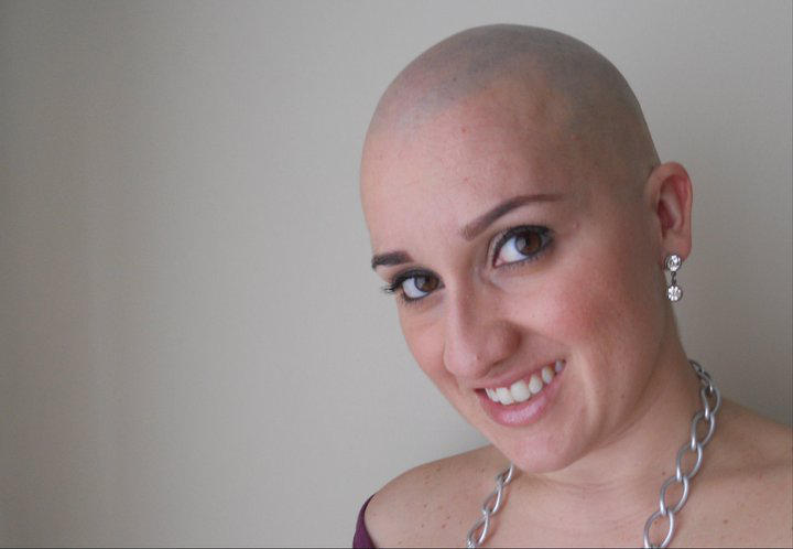 Você sabia que setembro também é o mês de conscientização de Alopecia Areata?